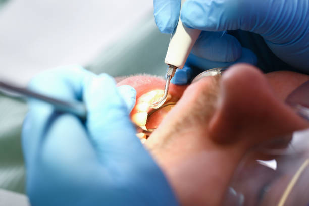 Best After-Hours Emergency Dentist in Fort Stewart, GA